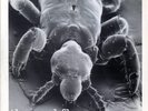Anal Fleas - 