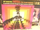 Pat Martino Lp Baiyina Psychedelic Jazz Guitar