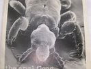 ANAL FLEAS 7