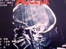 ACCEPT-DEATH ROW-2 LP-RCA FIRST PRESS-EX VINYL