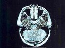 Breaking Benjamin: Dear Agony (English) Paperback Book