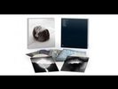 NEW The National Trouble Will Find Me Clear Vinyl LP Deluxe Box Set SEALED