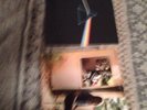 Vintage Record Albums Pink Floyd Dark Side Of The Moon And Ummagumma 3 Records