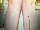 LOS CAMPESINOS**ROMANCE IS BORING**2VINYL