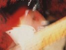 Dream Syndicate, The - Live At Raji's (2xLP, Album) - Vinyl - 72239