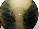 RARE ORIGINAL USSR X-RAY RECORD from 50's: