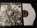 BROKEN BONES 