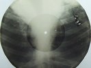 Caravan Benny Goodman Bones'n'ribs X-RAY roentgen film roentgenizdat 1950s USSR