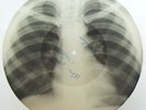 CONSOLINI Non volevo credere X-RAY roentgen film USSR roentgenizdat bones record