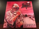 Death - Leprosy