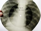 78rpm A. VERTINSKY My Star RARE USSR X-RAY AUDIO ROENTGEN Rib cage Thorax 1950