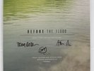 Before The Flood SIGNED Vinyl Trent Reznor Ross Santaolalla Nine Inch Nails NIN