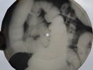 X-RAY 78rpm OSCAR ALEMAN Besame Mucho  USSR AUDIO ROENTGEN Bones