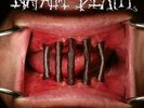 Napalm Death „Coded Smears And More Uncommon Slurs“ Gatefold RED 2LP&LP-Booklet