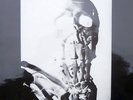EDDIE PREVOST BAND LIVE VOL. 2 RARE UK AVANT-GARDE VINYL LP ON MATCHLESS 1978