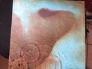 PINK FLOYD 'MEDDLE' MONSTER PSYCH/PROG ROCK LP UK PRESS 1971  TOP RARE