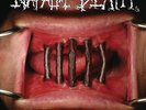 Napalm Death - Coded Smears And More Uncommon Slurs 2 X Vinyl LP New & Sealed