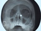 UNIQUE USSR X-RAY ROENTGEN SKULL BONES  - 7