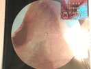 PINK FLOYD, MEDDLE 180 GRAM PICTURE DISC VINYL LP, 2018 EU IMPORT