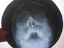 Ray Charles - What’d I Say - X-RAY  USSR ROENTGEN BONES Record - SKULL
