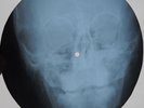 ROLLING STONES - BLUE TURNS TO GREY - GEORGIAN USSR X-RAY ROENTGEN SKULL BONES