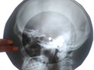 X-RAY The WHO - I Can't Explain UNIQUE USSR ROENTGEN BONES SKULL