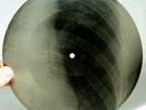 X-Ray 78rpm VERTINSKY sings 