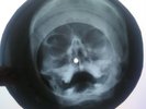 Frank Sinatra - Strangers in the Night X-RAY USSR ROENTGEN Bones Record Skull