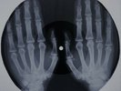 Who - The Seeker X-RAY USSR ROENTGEN Bones Record
