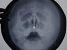 Roy Orbison - Oh, Pretty Woman X-RAY USSR ROENTGEN Bones Record Skull