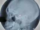 Nina Simone - My Baby Just Cares For Me X-RAY USSR ROENTGEN Bones Record Skull