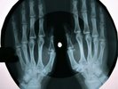 Beatles - Drive My Car  X-RAY USSR ROENTGEN Bones Record