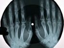 Elvis Presley - Blue Suede Shoes X-RAY USSR ROENTGEN Bones Record