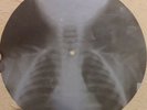 GRATEFUL DEAD - RAIN AND SNOW - USSR GEORGIAN X-RAY ROENTGEN BONES SKULL RECORD