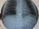 PEGGY LEE / BENNY GOODMAN - WHY DON'T YOU DO RIGHT -USSR GEORGIAN X-RAY ROENTGEN