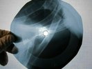 Five Satins Still of the Night X Ray USSR Vinyl Record Music on Bones Roentgen
