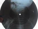 PINK FLOYD - LUCY LEAVE - UNIQUE USSR GEORGIAN X-RAY ROENTGEN BONES RECORD
