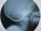 Nina Simone - Feeling Good X-RAY USSR ROENTGEN Bones Records SKULL
