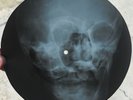ELVIS PRESLEY - KISS ME QUICK - UNIQUE USSR GEORGIAN X-RAY ROENTGEN SKULL RECORD