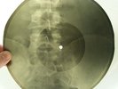X-RAY 78rpm PETRE LESCENCO 