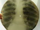 X-RAY 78rpm 10