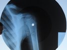 GRATEFUL DEAD - GOLDEN ROAD - GEORGIAN USSR X-RAY ROENTGEN BONES RECORD