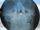DOORS - LOVE HER MADLY - USSR GEORGIAN UNIQUE X-RAY ROENTGEN SKULL BONES RECORD