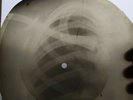 USSR GEORGIAN X-RAY ROENTGEN SKULL  RECORD  UNIQUE ITEM