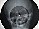 Shadows - Apache  X-RAY OF THE USSR BONE X-RAY RECORDING  9.0