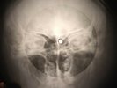 Bob Marley - Roots, Rock, Reggae X-RAY BONE OF THE USSR X-RAY RECORDING