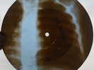 THE BEATLES - LONG TALL SALLY - USSR GEORGIAN X-RAY ROENTGEN BONES RECORD
