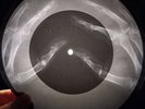 Beatles - Can't Buy Me Love X-RAY BONE OF THE USSR X-RAY RECORDING