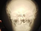 Who - Happy Jack X-RAY BONE OF THE USSR X-RAY RECORDING