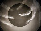 Elvis Presley - Like a Baby X-RAY BONE OF THE USSR X-RAY RECORDING